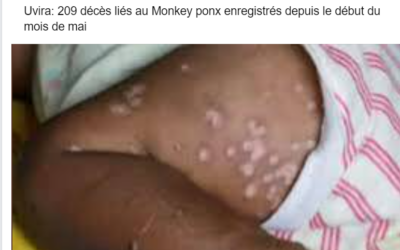 Faux, 209 personnes ne sont pas décédées de Monkey Pox à Uvira